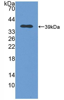 Polyclonal Antibody to Metallothionein 2 (MT2)