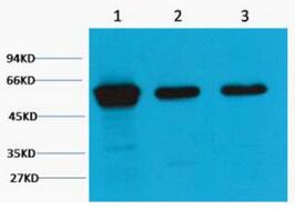 Vimentin Monoclonal Antibody