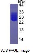 Eukaryotic Interleukin 6 (IL6)
