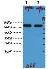 ABCB5; ATP-binding cassette sub-family B member 5; ABCB5 P-gp; P-glycoprotein AB