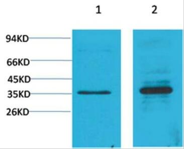 Cyclin D1 Polyclonal Antibody