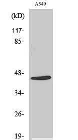 Cleaved-MASP-1 HC (R448) Polyclonal Antibody