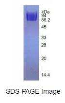 Eukaryotic Vascular Endothelial Growth Factor Receptor 2 (VEGFR2)