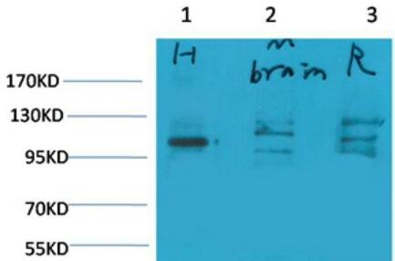 Glutamate Receptor 1 Polyclonal Antibody