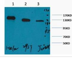 PARP Monoclonal Antibody