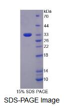 Recombinant Eukaryotic Translation Initiation Factor 3M (EIF3M)