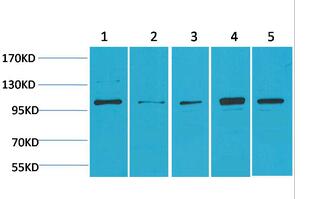 ERK 5 Polyclonal Antibody