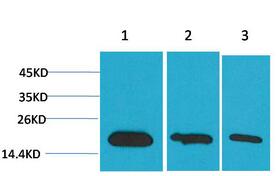 Survivin Monoclonal Antibody