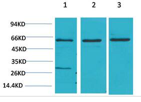 Akt2 Polyclonal Antibody