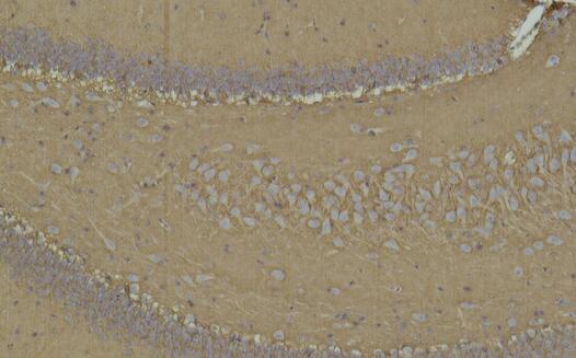 CD15 Monoclonal Antibody