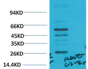 TGFβ1 Polyclonal Antibody