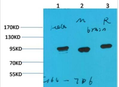 HSP90 α Monoclonal Antibody