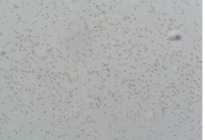 Cav3.2 Polyclonal Antibody