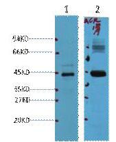 AMACR Monoclonal Antibody