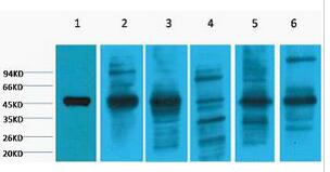 Cytokeratin 18 Monoclonal Antibody