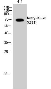 Ku-70 (Acetyl Lys331) Polyclonal Antibody