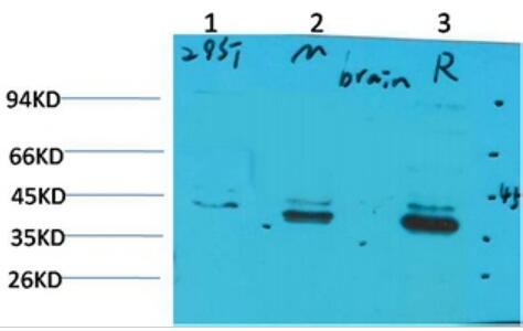 CABP2 Polyclonal Antibody