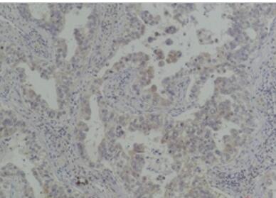 Bcl-Xl Polyclonal Antibody