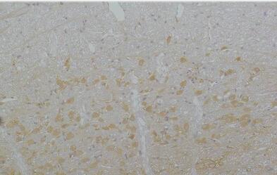 Cav3.3 Polyclonal Antibody
