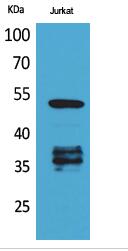 p53 (Acetyl Lys370) Polyclonal Antibody
