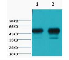 β II tubulin Monoclonal Antibody
