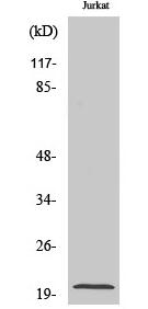 Cleaved-Caspase-7 p20 (D198) Polyclonal Antibody