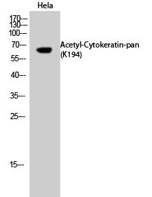 Cytokeratin-pan (Acetyl Lys194) Polyclonal Antibo