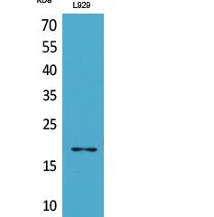 Acetyl eIF5A/eIF5A2 (K47) Polyclonal Antibody
