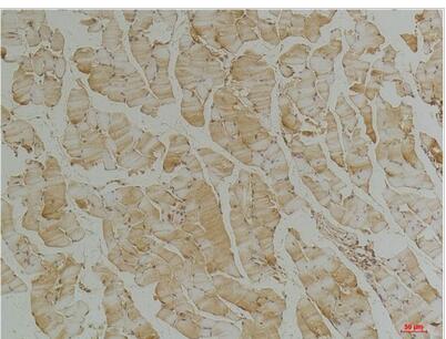 Desmin Monoclonal Antibody