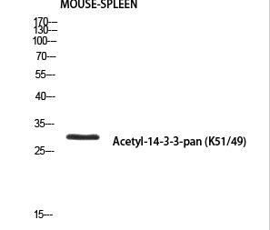 14-3-3-pan (Acetyl Lys51/49) Polyclonal Antibody