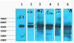 Cytokeratin 18 Monoclonal Antibody