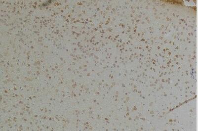 KChIP1 Polyclonal Antibody