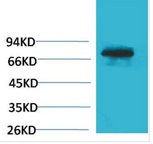 TF Polyclonal Antibody