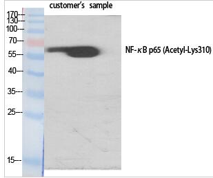 NFκB-p65 (Acetyl Lys310) Polyclonal Antibody
