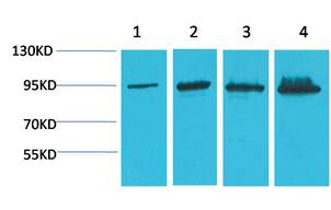 Catenin-β Monoclonal Antibody