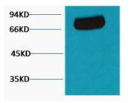Transferrin Monoclonal Antibody