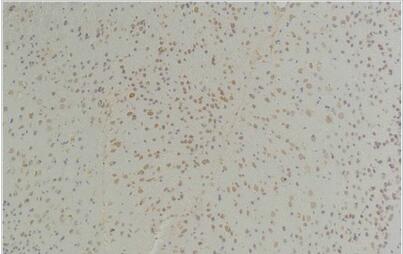Connexin-26 Polyclonal Antibody