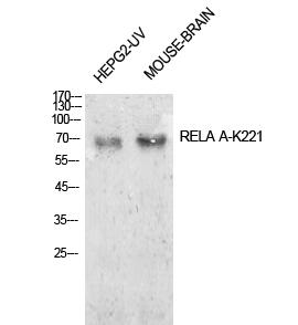 NFκB-p65 (Acetyl Lys221) Polyclonal Antibody