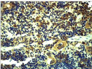 TLR6 Polyclonal Antibody