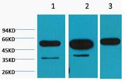 β-tubulin Monoclonal Antibody