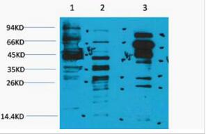 Acetyl Kine Polyclonal Antibody