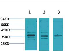 CACNG2 Polyclonal Antibody