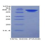 Native Glycated Hemoglobin A1c (HbA1c)