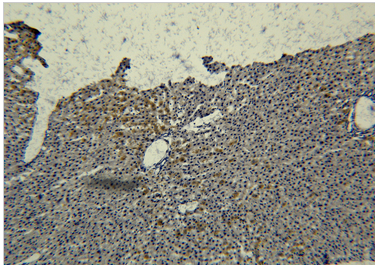 Transferrin Monoclonal Antibody
