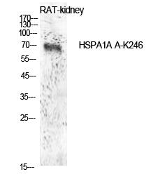 HSP70 (Acetyl Lys246) Polyclonal Antibody