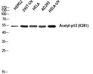 p53 (Acetyl Lys381) Polyclonal Antibody