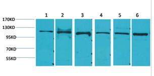 Stat2 Polyclonal Antibody