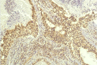 P70 S6 Kinase Mouse Monoclonal Antibody(1C7)