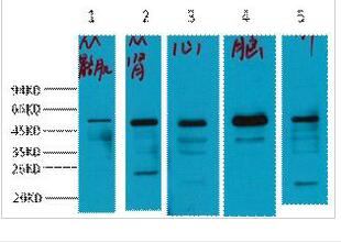 α-tubulin Polyclonal Antibody