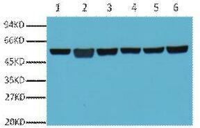 β-Tubulin Monoclonal Antibody